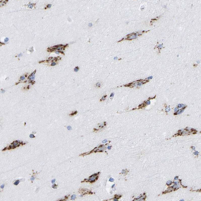 TMEM87A Antibody - BSA Free Immunohistochemistry: TMEM87A Antibody - BSA Free [NBP1-90531]