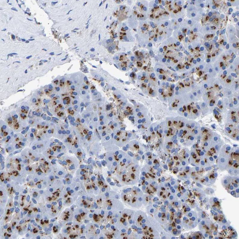 TMEM87A Antibody - BSA Free Immunohistochemistry: TMEM87A Antibody - BSA Free [NBP1-90531]