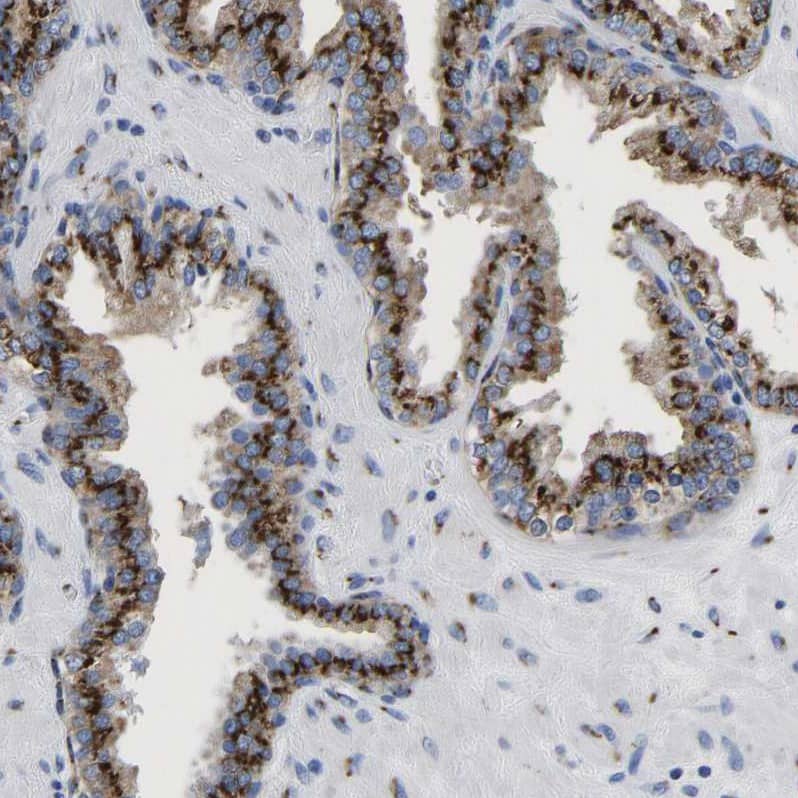 TMEM87A Antibody - BSA Free Immunohistochemistry: TMEM87A Antibody - BSA Free [NBP1-90532]