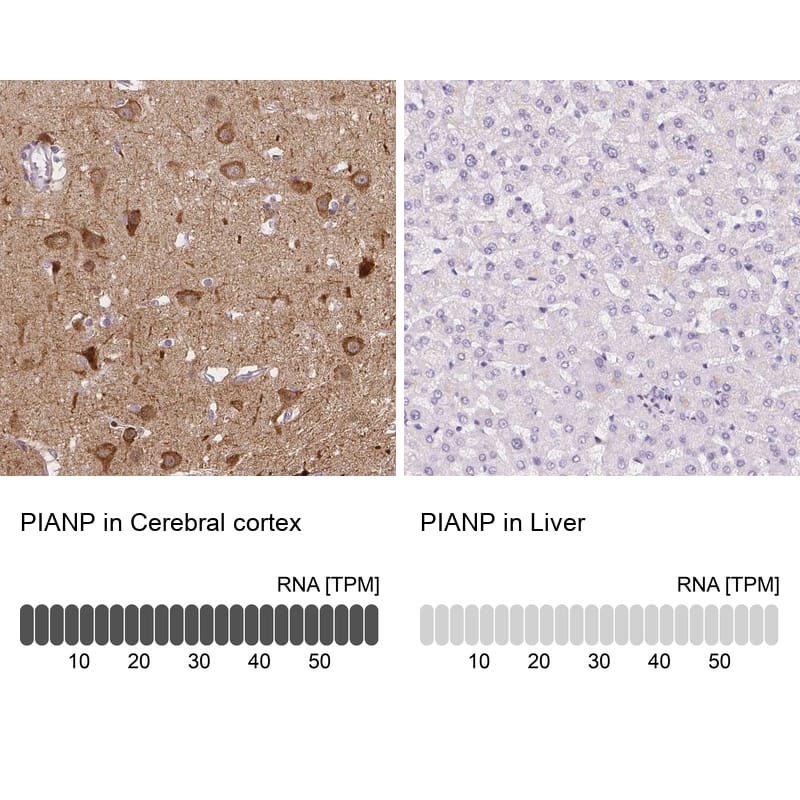 PANP/PILR alpha associated neural protein Antibody - BSA Free Immunohistochemistry: PANP/PILR alpha associated neural protein Antibody - BSA Free [NBP1-90541]
