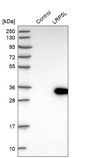 LRP5L Antibody - BSA Free Western Blot: LRP5L Antibody - BSA Free [NBP1-90543]
