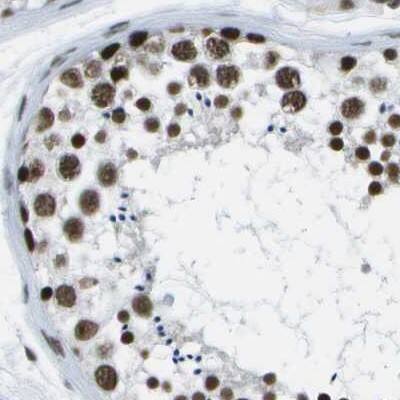 NSRP1 Antibody - BSA Free Immunohistochemistry-Paraffin: NSRP1 Antibody [NBP1-90548]