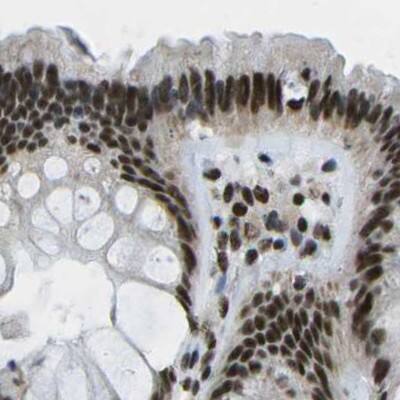 NSRP1 Antibody - BSA Free Immunohistochemistry-Paraffin: NSRP1 Antibody [NBP1-90548]