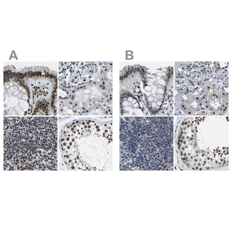 NSRP1 Antibody - BSA Free Immunohistochemistry-Paraffin: NSRP1 Antibody [NBP1-90548]
