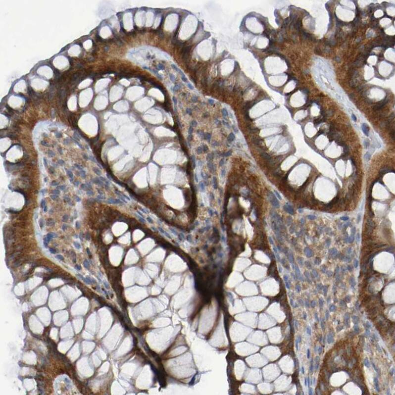 LMBRD2 Antibody - BSA Free Immunohistochemistry: LMBRD2 Antibody - BSA Free [NBP1-90551]