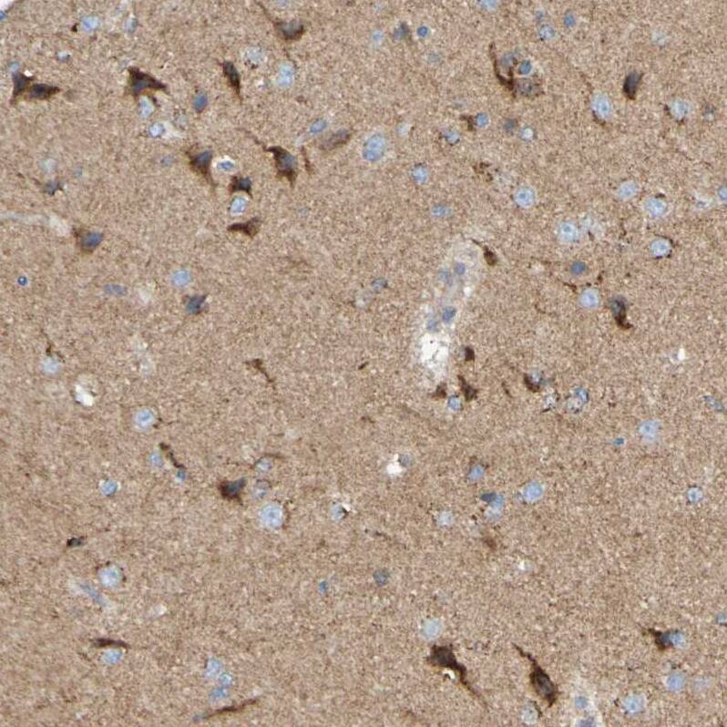 LMBRD2 Antibody - BSA Free Immunohistochemistry: LMBRD2 Antibody - BSA Free [NBP1-90551]