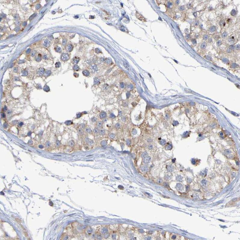 LMBRD2 Antibody - BSA Free Immunohistochemistry: LMBRD2 Antibody - BSA Free [NBP1-90551]