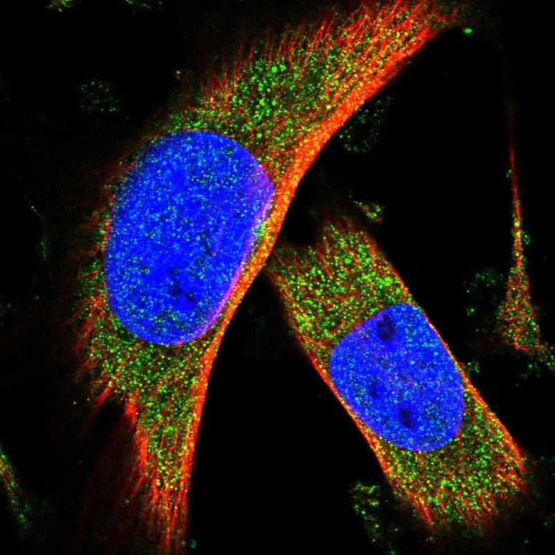 C15orf39 Antibody - BSA Free Immunocytochemistry/ Immunofluorescence: C15orf39 Antibody [NBP1-90552]