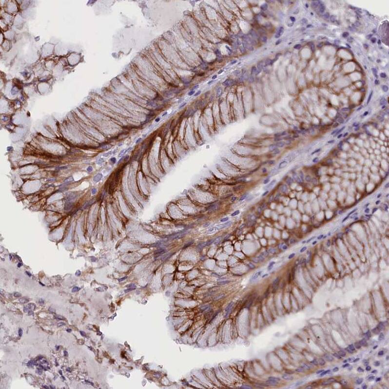 rotatin Antibody - BSA Free Immunohistochemistry: rotatin Antibody - BSA Free [NBP1-90555]