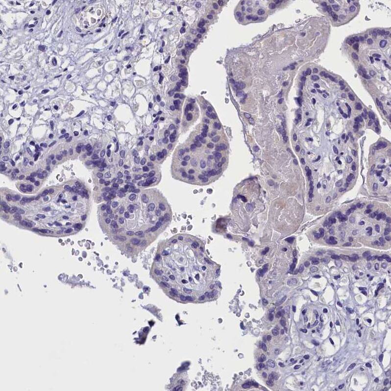 rotatin Antibody - BSA Free Immunohistochemistry: rotatin Antibody - BSA Free [NBP1-90555]
