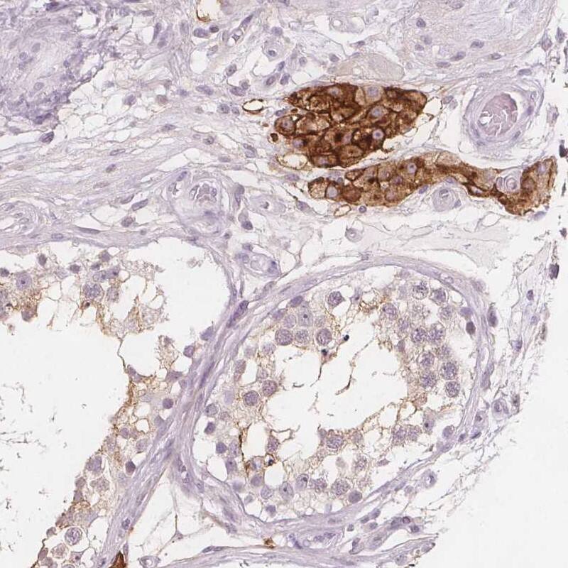 C1orf167 Antibody - BSA Free Immunohistochemistry: C1orf167 Antibody - BSA Free [NBP1-90556]