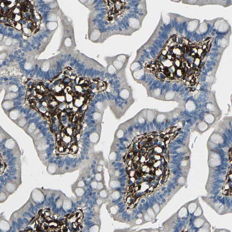 GRAMD1C Antibody - BSA Free Immunohistochemistry: GRAMD1C Antibody - BSA Free [NBP1-90559]