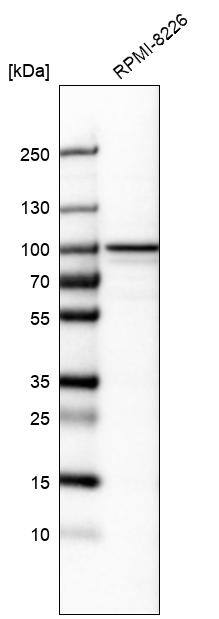 CCDC39 Antibody - BSA Free Western Blot: CCDC39 Antibody - BSA Free [NBP1-90560]