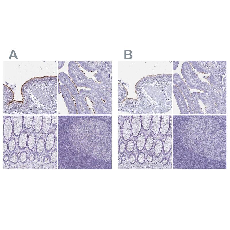 CCDC39 Antibody - BSA Free Immunohistochemistry: CCDC39 Antibody - BSA Free [NBP1-90560]