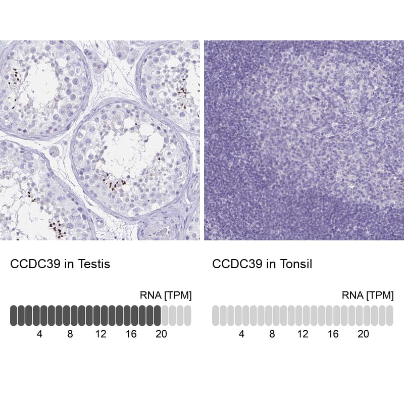 CCDC39 Antibody - BSA Free Immunohistochemistry: CCDC39 Antibody - BSA Free [NBP1-90560]