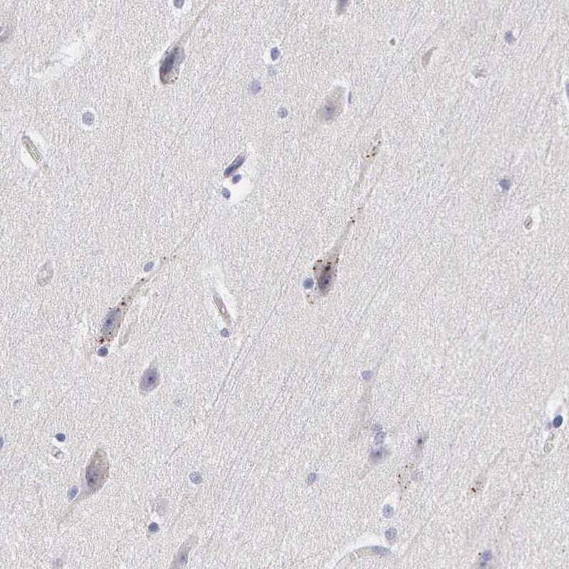 ELFN2 Antibody - BSA Free Immunohistochemistry: ELFN2 Antibody - BSA Free [NBP1-90569]