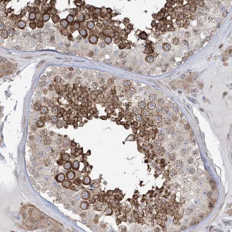 SOGA3 Antibody - BSA Free Immunohistochemistry-Paraffin: SOGA3 Antibody [NBP1-90575]