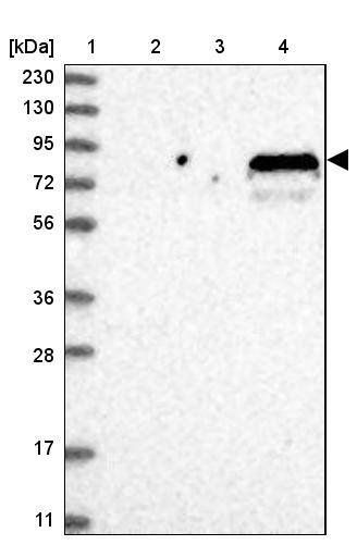 SOGA3 Antibody - BSA Free Western Blot: SOGA3 Antibody - BSA Free [NBP1-90575]