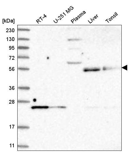 UNC93A Antibody - BSA Free Western Blot: UNC93A Antibody - BSA Free [NBP1-90576]