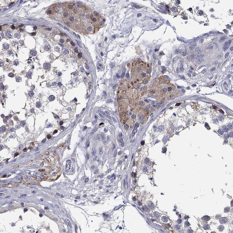 CFAP61 Antibody - BSA Free Immunohistochemistry: CFAP61 Antibody - BSA Free [NBP1-90583]