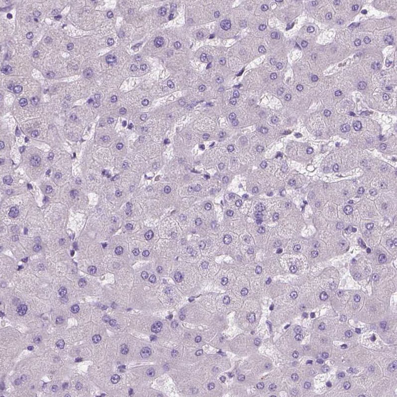 DNAH12 Antibody - BSA Free Immunohistochemistry: DNAH12 Antibody - BSA Free [NBP1-90586]