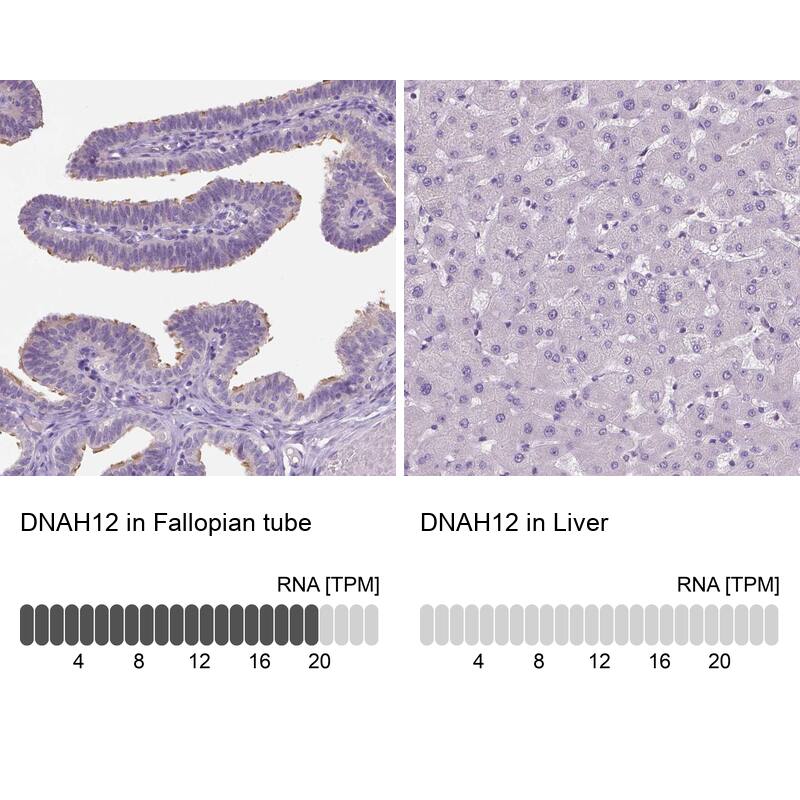 DNAH12 Antibody - BSA Free Immunohistochemistry: DNAH12 Antibody - BSA Free [NBP1-90586]