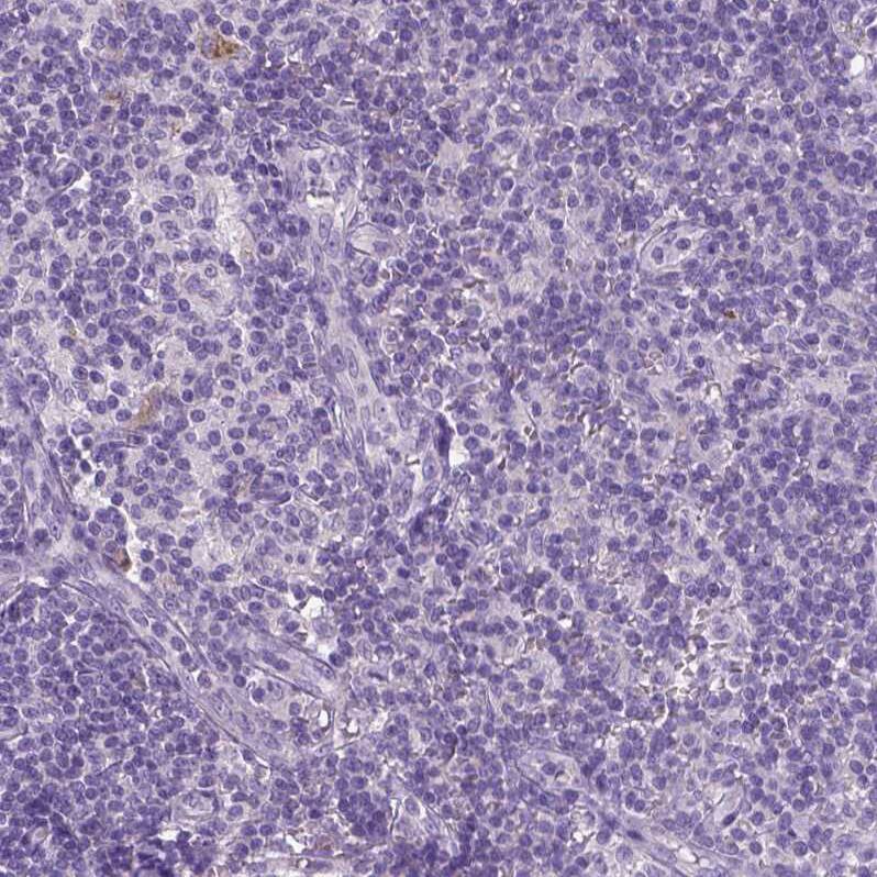 DNAH12 Antibody - BSA Free Immunohistochemistry: DNAH12 Antibody - BSA Free [NBP1-90586]