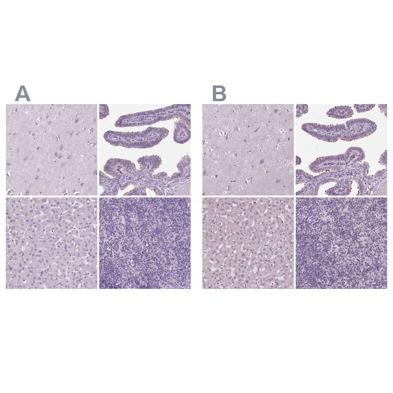 DNAH12 Antibody - BSA Free Immunohistochemistry: DNAH12 Antibody - BSA Free [NBP1-90586]