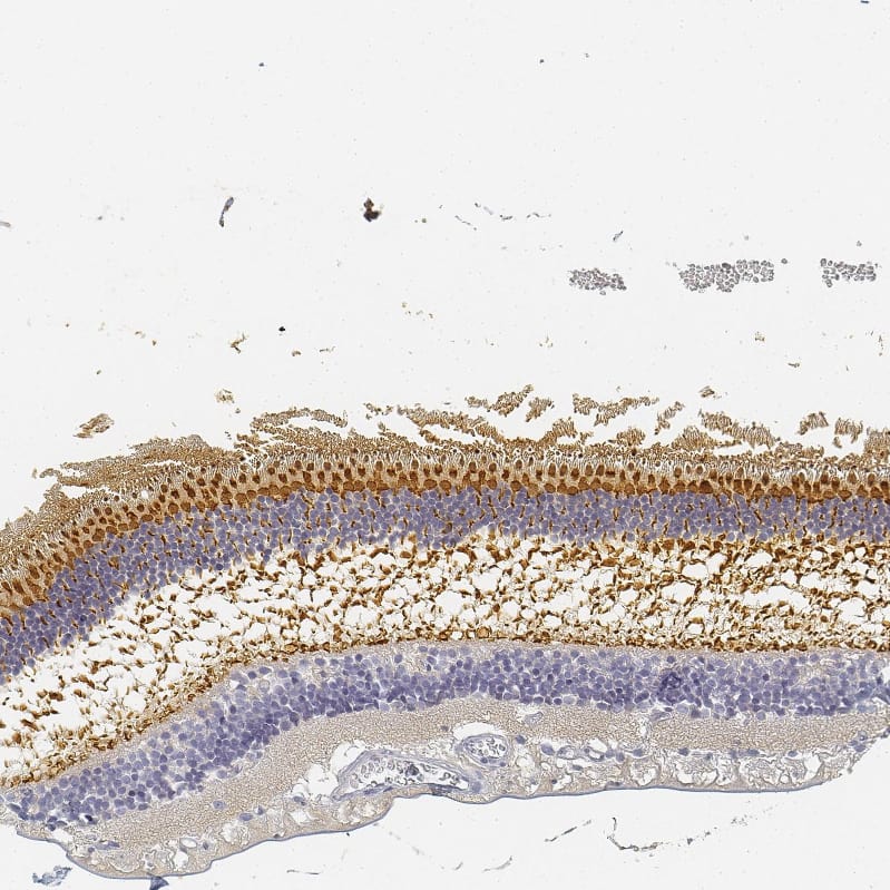 RP1 Antibody - BSA Free Immunohistochemistry: RP1 Antibody - BSA Free [NBP1-90597]