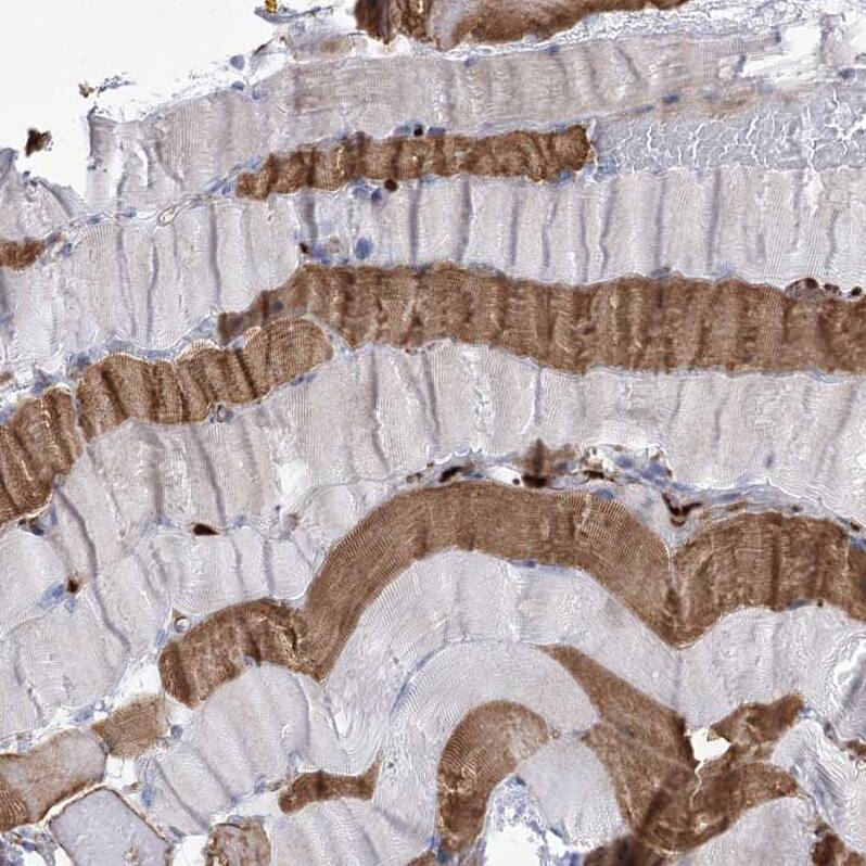 ANKRD23 Antibody - BSA Free Immunohistochemistry: ANKRD23 Antibody - BSA Free [NBP1-90599]