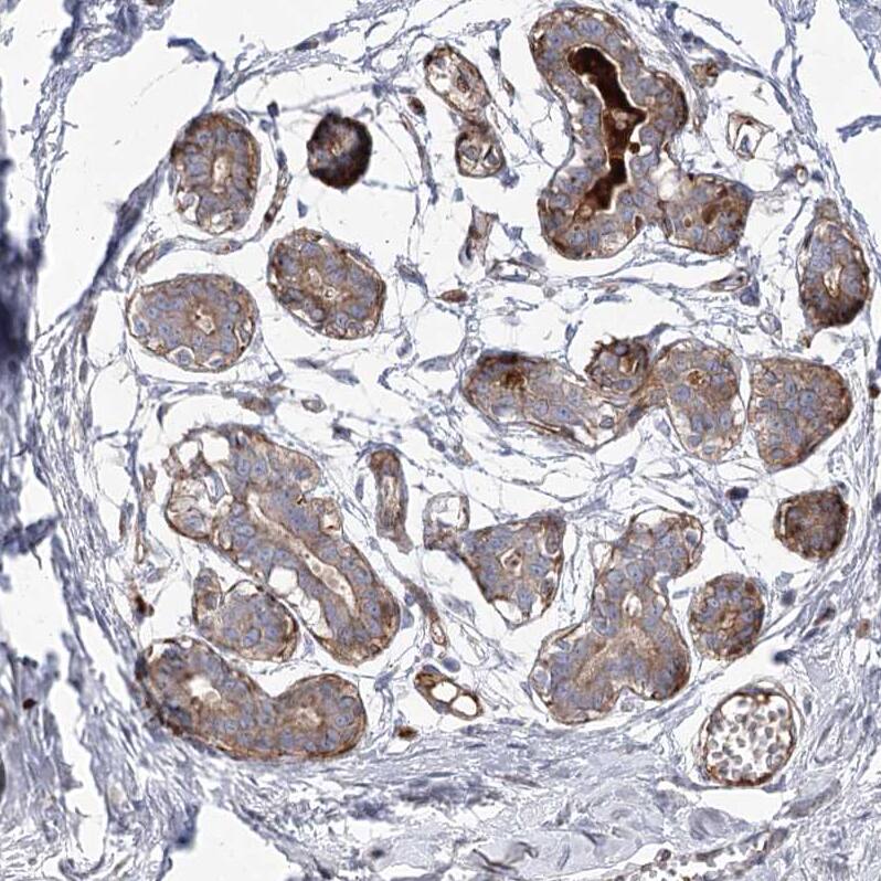 ANKRD23 Antibody - BSA Free Immunohistochemistry: ANKRD23 Antibody - BSA Free [NBP1-90599]