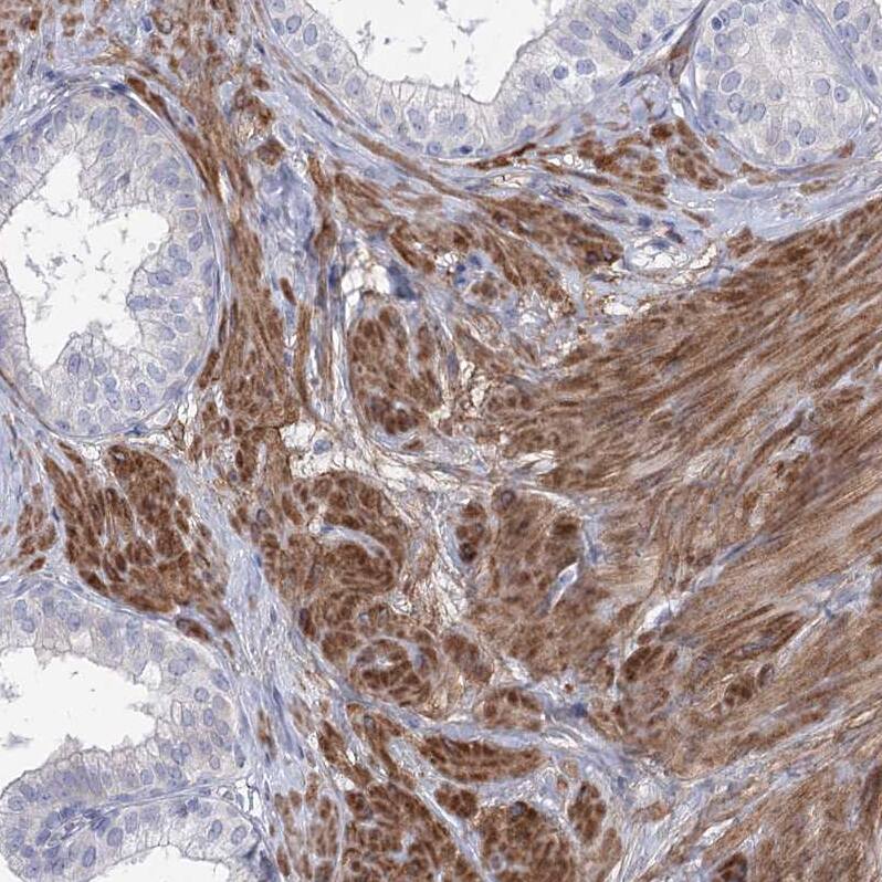 ANKRD23 Antibody - BSA Free Immunohistochemistry: ANKRD23 Antibody - BSA Free [NBP1-90599]