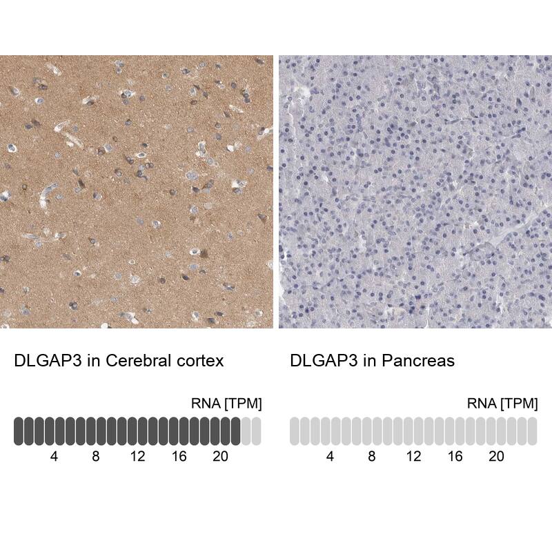 DLGAP3 Antibody - BSA Free Immunohistochemistry: DLGAP3 Antibody - BSA Free [NBP1-90601]