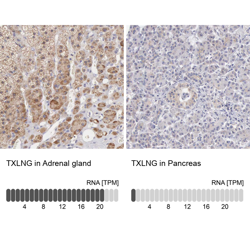 taxilin gamma Antibody - BSA Free Immunohistochemistry: taxilin gamma Antibody - BSA Free [NBP1-90606]