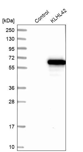 KLHDC5 Antibody - BSA Free Western Blot: KLHDC5 Antibody - BSA Free [NBP1-90612]