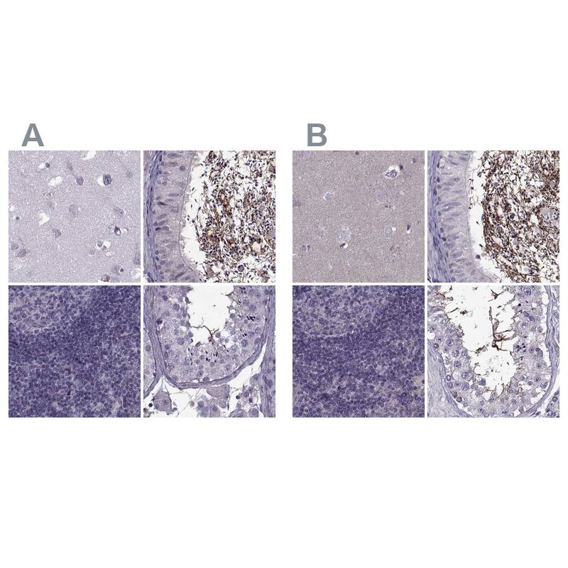 ODF3 Antibody - BSA Free Immunohistochemistry: ODF3 Antibody - BSA Free [NBP1-90614]