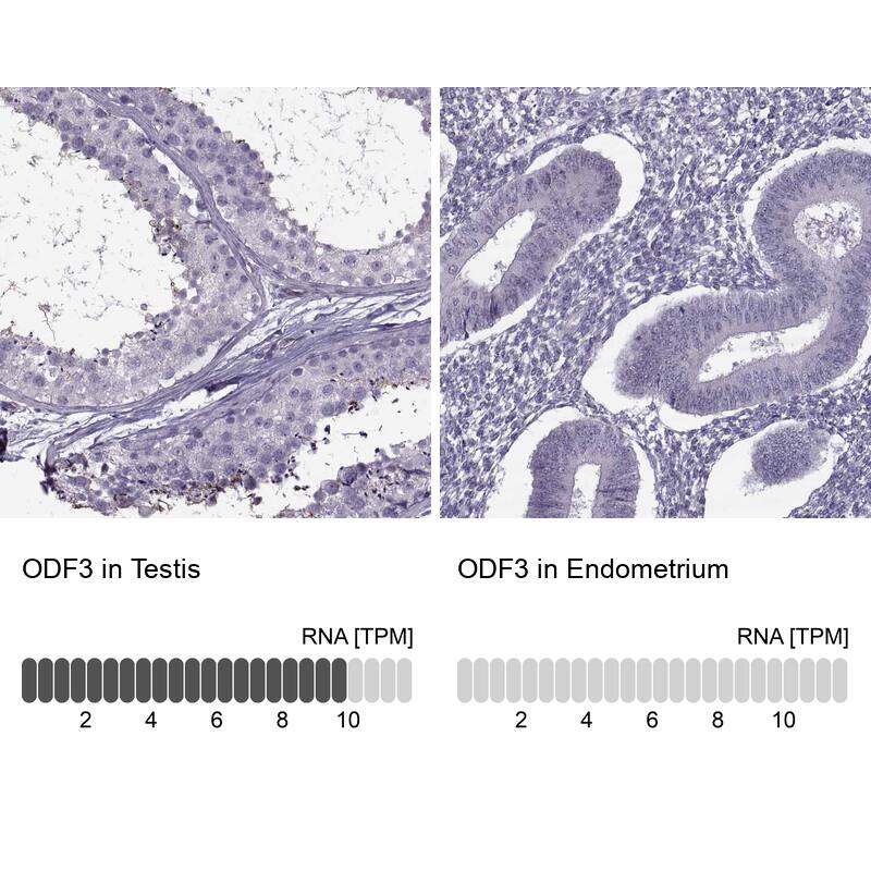 ODF3 Antibody - BSA Free Immunohistochemistry: ODF3 Antibody - BSA Free [NBP1-90614]