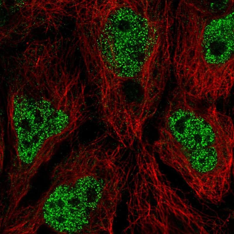 AIM1L Antibody - BSA Free Immunocytochemistry/ Immunofluorescence: AIM1L Antibody - BSA Free [NBP1-90618]