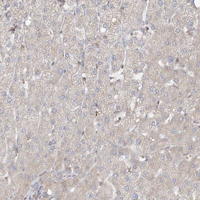 CNP/NPPC Antibody - BSA Free Immunohistochemistry: CNP/NPPC Antibody - BSA Free [NBP1-90623]
