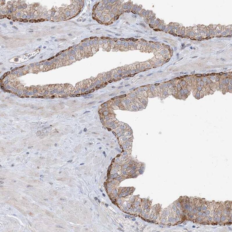 CNP/NPPC Antibody - BSA Free Immunohistochemistry: CNP/NPPC Antibody - BSA Free [NBP1-90623]