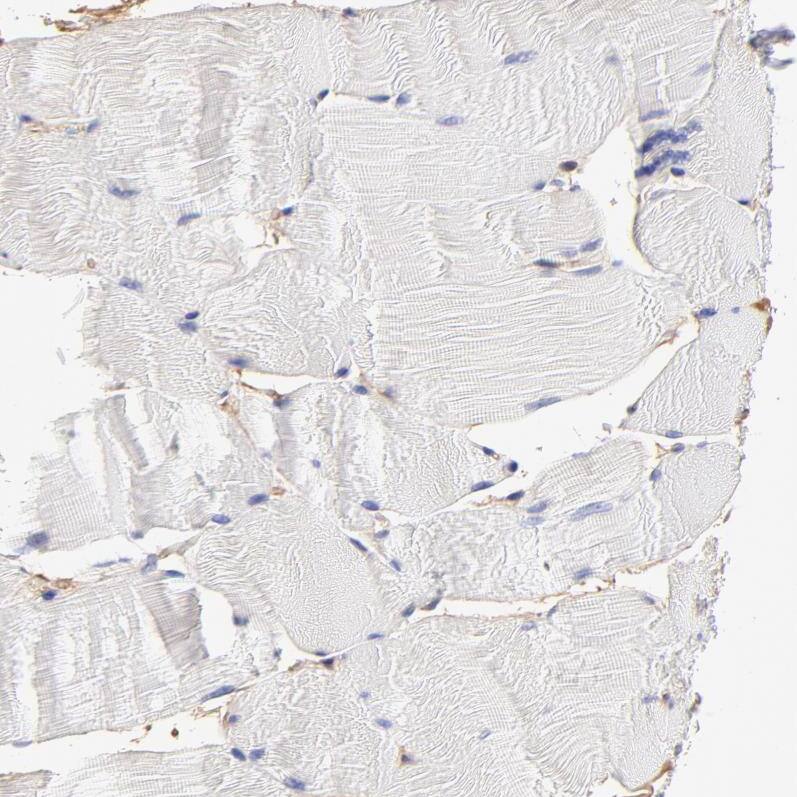 CD2AP Antibody - BSA Free Immunohistochemistry: CD2AP Antibody - BSA Free [NBP1-90625]