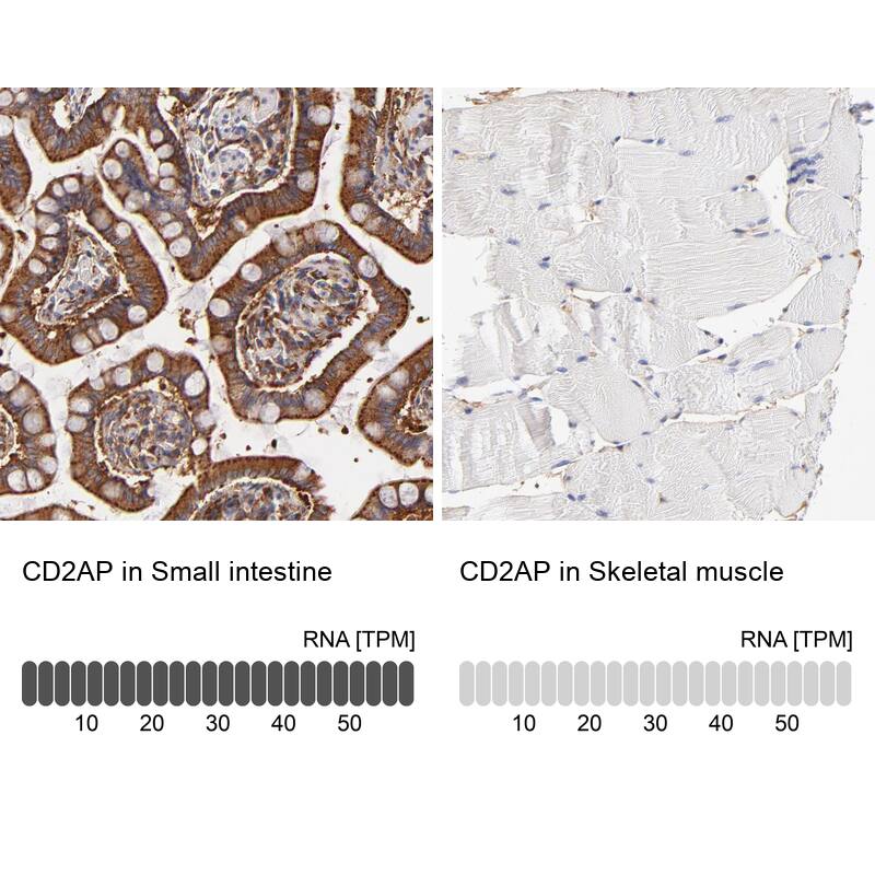 CD2AP Antibody - BSA Free Immunohistochemistry: CD2AP Antibody - BSA Free [NBP1-90625]