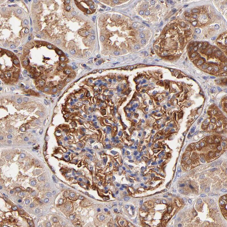 CD2AP Antibody - BSA Free Immunohistochemistry: CD2AP Antibody - BSA Free [NBP1-90625]