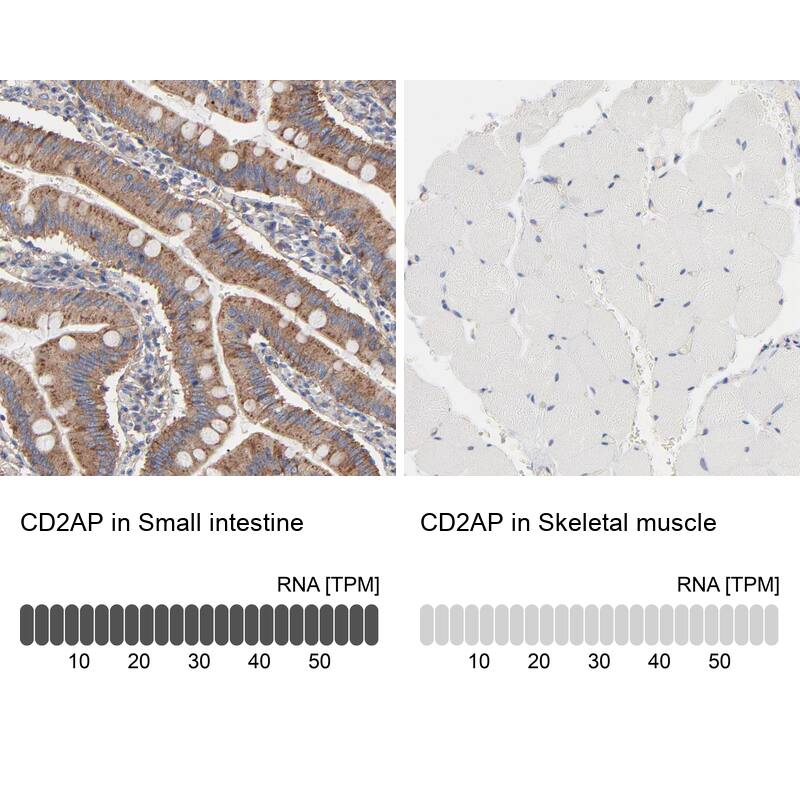 CD2AP Antibody - BSA Free Immunohistochemistry: CD2AP Antibody - BSA Free [NBP1-90626]