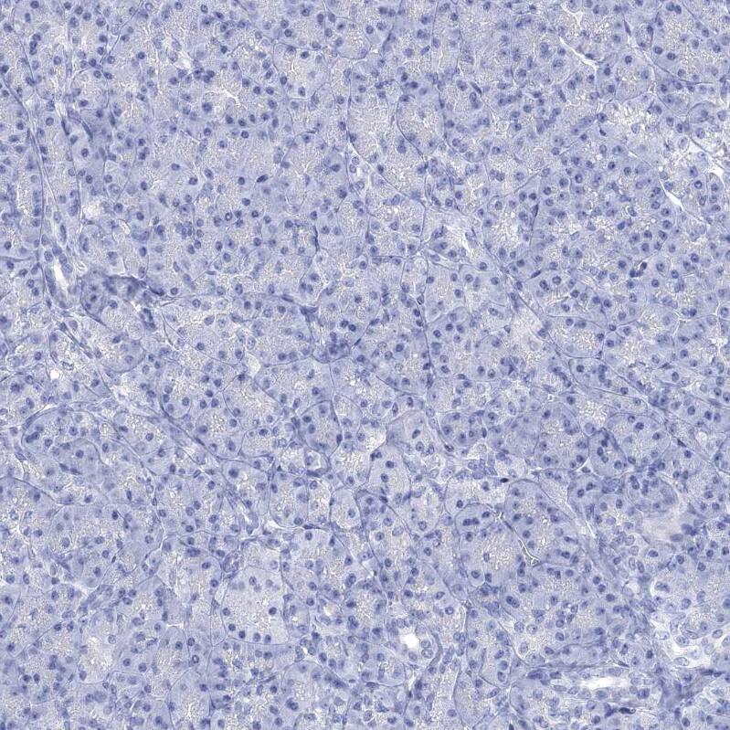 NLRP14 Antibody - BSA Free Immunohistochemistry: NLRP14 Antibody - BSA Free [NBP1-90627]