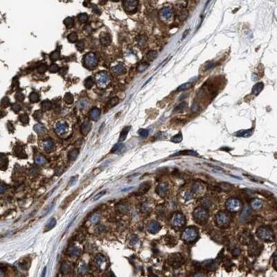 kinectin Antibody - BSA Free Immunohistochemistry: kinectin Antibody - BSA Free [NBP1-90635]