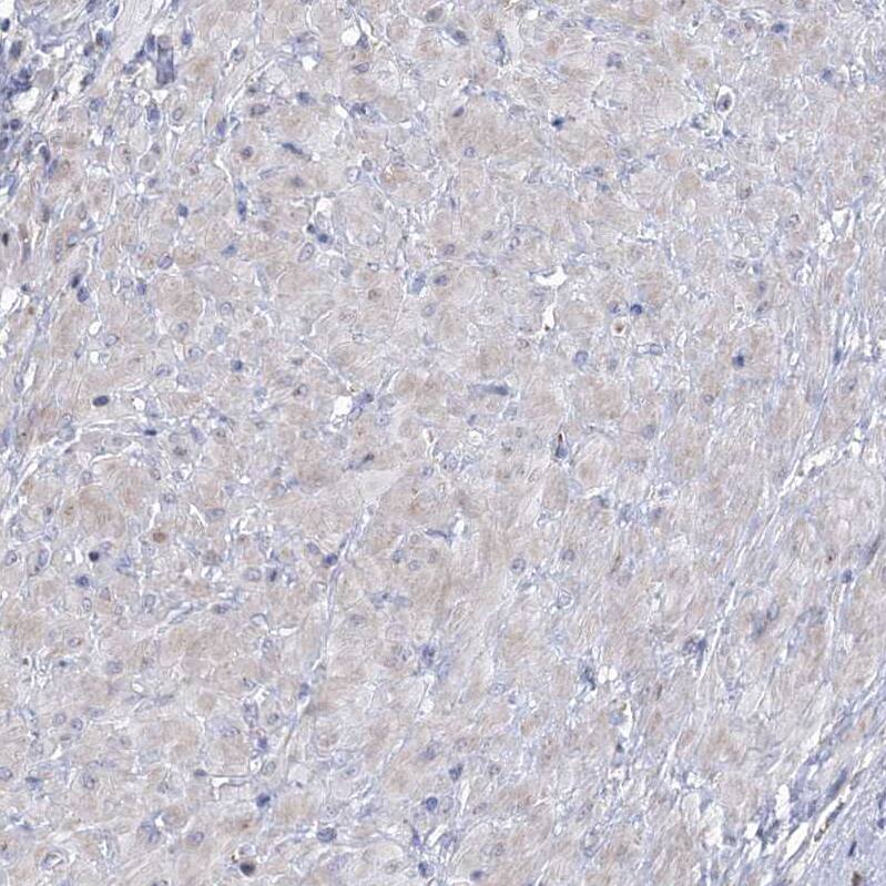 carboxylesterase 4A Antibody - BSA Free Immunohistochemistry: carboxylesterase 4A Antibody - BSA Free [NBP1-90638]