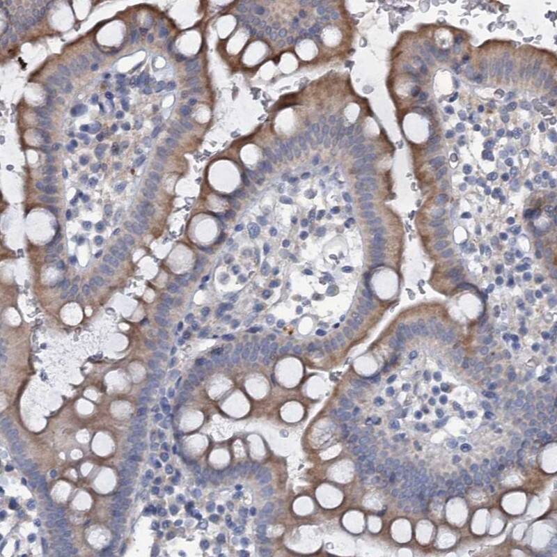 PRHOXNB Antibody - BSA Free Immunohistochemistry-Paraffin: PRHOXNB Antibody [NBP1-90645]