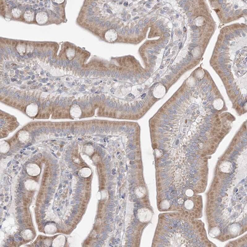 MMGT1 Antibody - BSA Free Immunohistochemistry: MMGT1 Antibody - BSA Free [NBP1-90652]