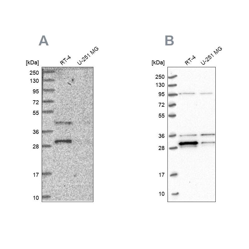 PPTC7 Antibody - BSA Free Western Blot: PPTC7 Antibody - BSA Free [NBP1-90653]